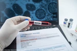 Surto de Mpox na África faz OMS declarar emergência global