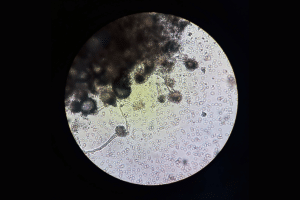 Entenda o que é o superfungo identificado em hospital de BH e capaz de escapar de remédios